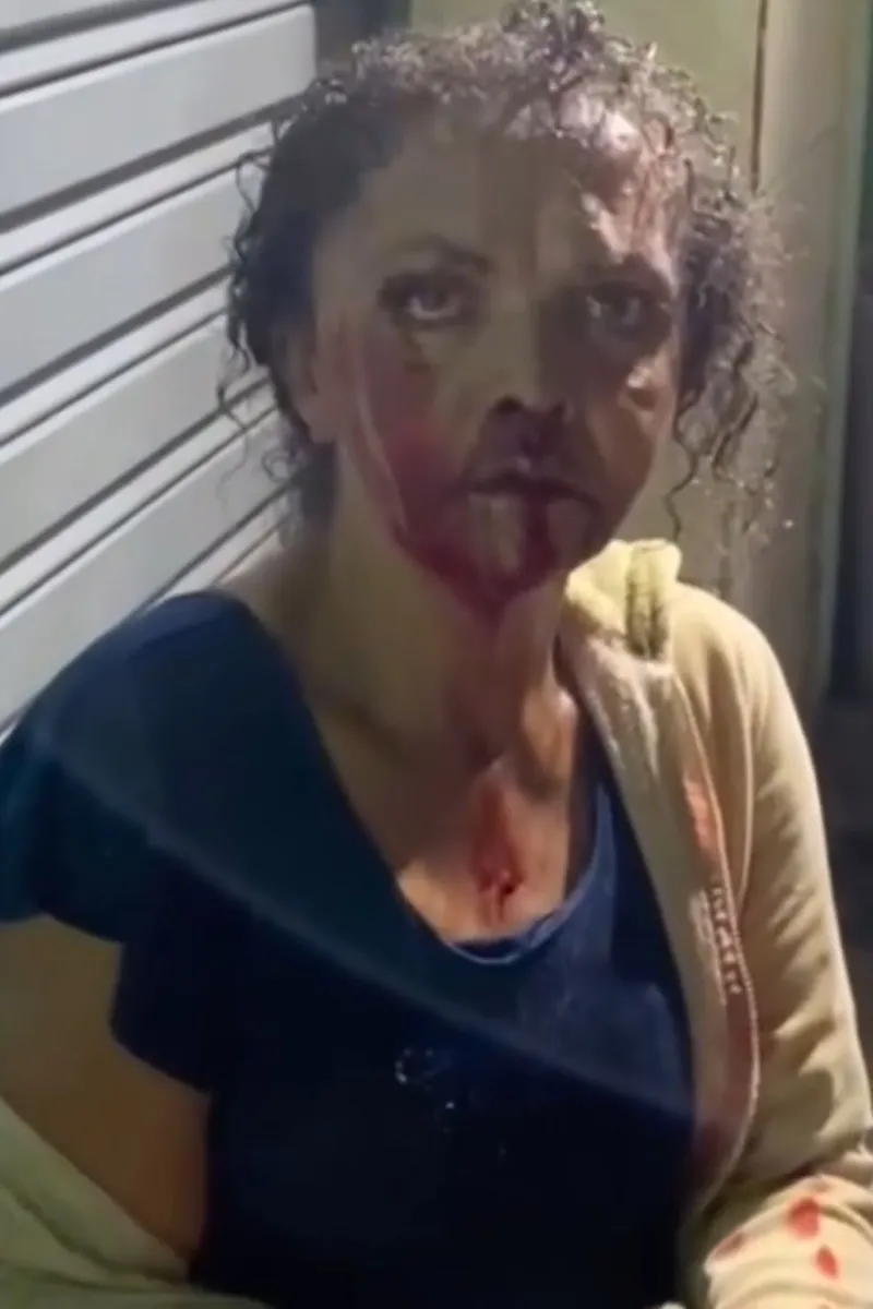 Imagem da agressão noticiada em Quebrangulo