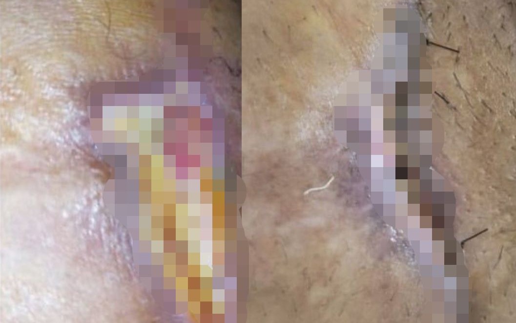 Imagem relacionada às denúncias acompanhadas por Júlia Nunes em Maceió